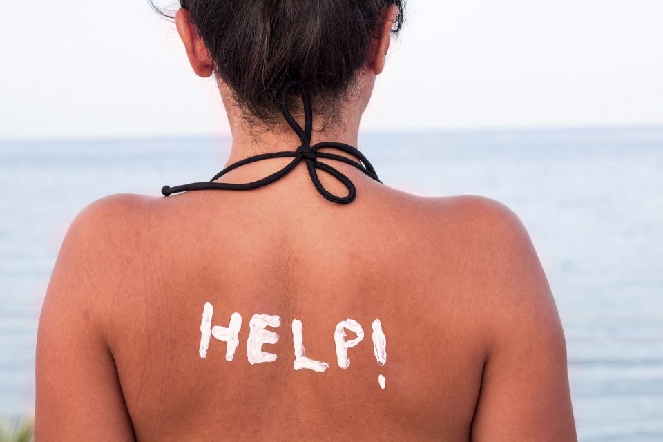Was hilft bei Sonnenbrand? Tipps zu Hausmitteln & Co. | Urlaubsguru